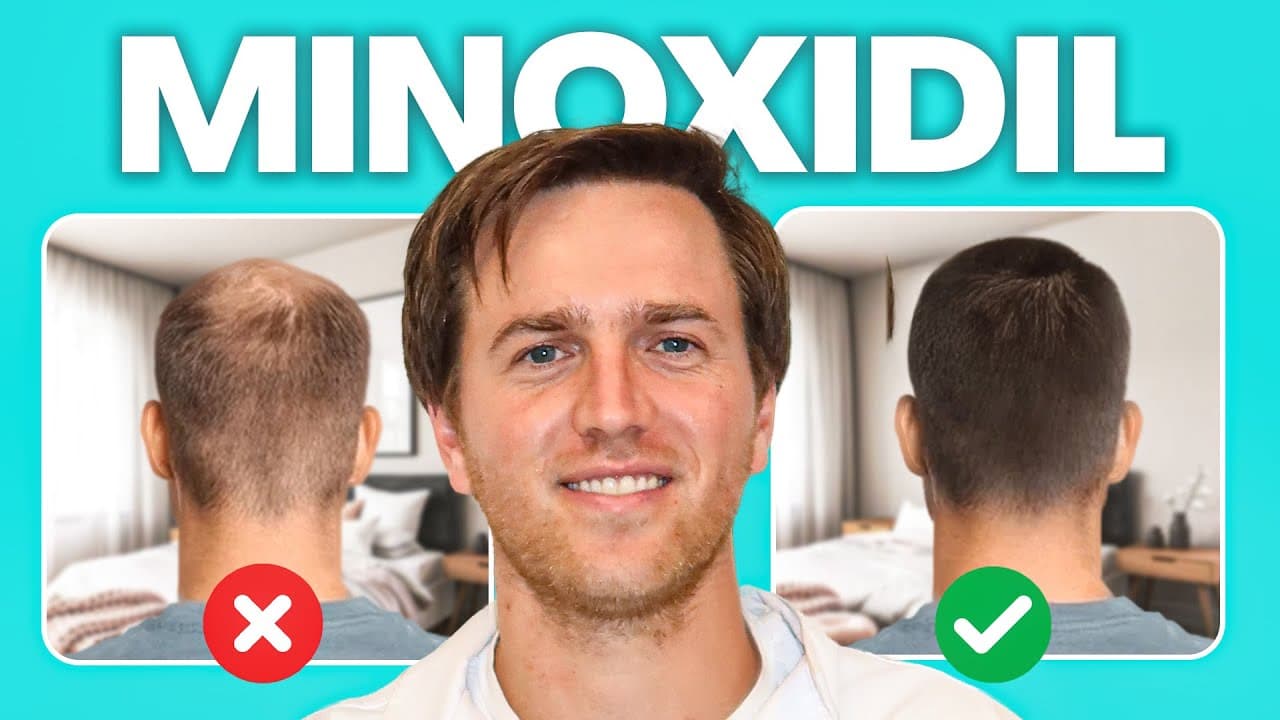 10 Things No One Tells You About Minoxidil (But You should Know)