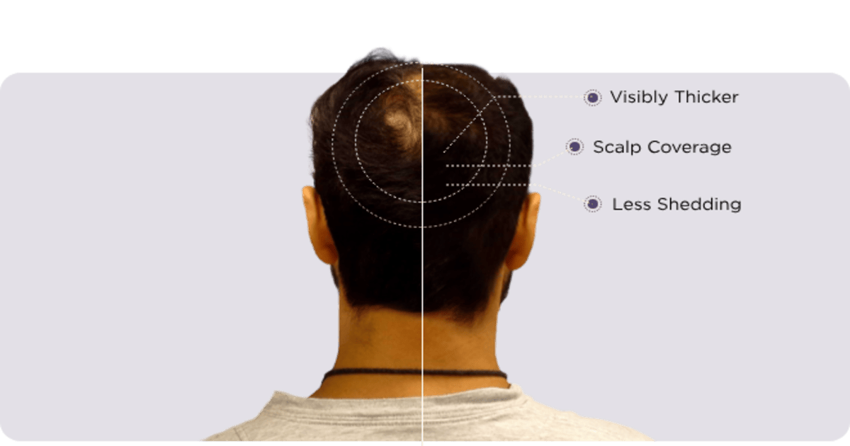 Anagen by HairDAO | Custom Hair Loss Treatments & Telehealth